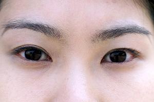 黒アザがある場合はこの病院に通うべき